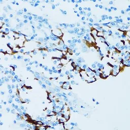 Anti-Cathepsin E antibody used in IHC (Paraffin sections) (IHC-P). GTX33064