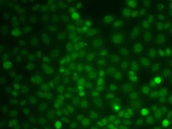 Anti-CBLC antibody used in Immunocytochemistry/ Immunofluorescence (ICC/IF). GTX33067