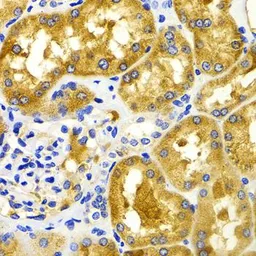Anti-CCRK antibody used in IHC (Paraffin sections) (IHC-P). GTX33072