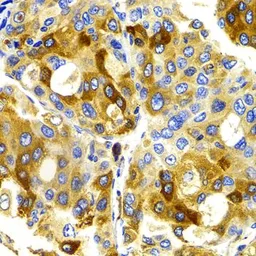 Anti-CCRK antibody used in IHC (Paraffin sections) (IHC-P). GTX33072