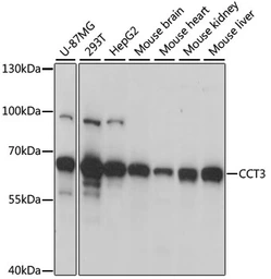 Anti-TCP1 gamma antibody used in Western Blot (WB). GTX33073
