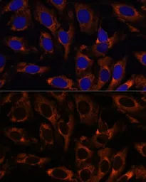 Anti-TCP1 gamma antibody used in Immunocytochemistry/ Immunofluorescence (ICC/IF). GTX33073