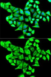 Anti-CD22 antibody used in Immunocytochemistry/ Immunofluorescence (ICC/IF). GTX33075
