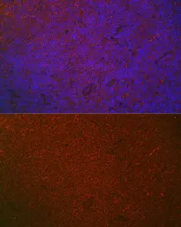 Anti-CD32a antibody used in IHC (Paraffin sections) (IHC-P). GTX33078