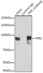 Anti-CD71 antibody used in Immunoprecipitation (IP). GTX33080