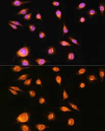Anti-CD71 antibody used in Immunocytochemistry/ Immunofluorescence (ICC/IF). GTX33080