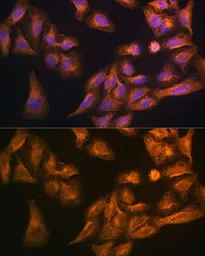 Anti-CD71 antibody used in Immunocytochemistry/ Immunofluorescence (ICC/IF). GTX33080