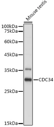 Anti-CDC34 antibody used in Western Blot (WB). GTX33081