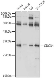 Anti-CDC34 antibody used in Western Blot (WB). GTX33081