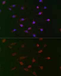 Anti-CDC34 antibody used in Immunocytochemistry/ Immunofluorescence (ICC/IF). GTX33081