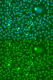 Anti-CDK10 antibody used in Immunocytochemistry/ Immunofluorescence (ICC/IF). GTX33084