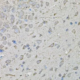 Anti-CDK10 antibody used in IHC (Paraffin sections) (IHC-P). GTX33084