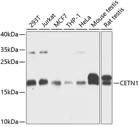 Anti-Centrin 1 antibody used in Western Blot (WB). GTX33091