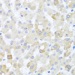 Anti-Centrin 1 antibody used in IHC (Paraffin sections) (IHC-P). GTX33091