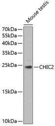 Anti-CHIC2 antibody used in Western Blot (WB). GTX33094