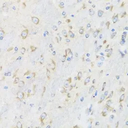Anti-CHIC2 antibody used in IHC (Paraffin sections) (IHC-P). GTX33094