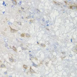 Anti-CHIC2 antibody used in IHC (Paraffin sections) (IHC-P). GTX33094