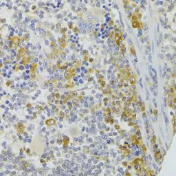 Anti-CIKS antibody used in IHC (Paraffin sections) (IHC-P). GTX33095