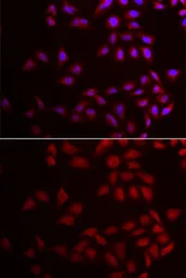 Anti-CIRBP antibody used in Immunocytochemistry/ Immunofluorescence (ICC/IF). GTX33096
