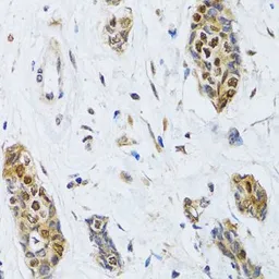 Anti-CIRBP antibody used in IHC (Paraffin sections) (IHC-P). GTX33096