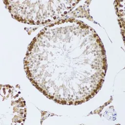 Anti-CIRBP antibody used in IHC (Paraffin sections) (IHC-P). GTX33096