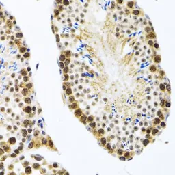Anti-CIRBP antibody used in IHC (Paraffin sections) (IHC-P). GTX33096