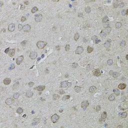 Anti-CKAP4 antibody used in IHC (Paraffin sections) (IHC-P). GTX33097