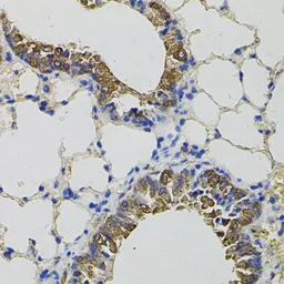 Anti-CKAP4 antibody used in IHC (Paraffin sections) (IHC-P). GTX33097