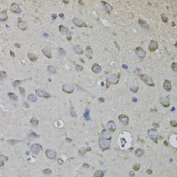 Anti-CKAP4 antibody used in IHC (Paraffin sections) (IHC-P). GTX33097