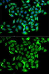 Anti-CLASP1 antibody used in Immunocytochemistry/ Immunofluorescence (ICC/IF). GTX33099