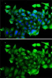 Anti-CLIC4 antibody used in Immunocytochemistry/ Immunofluorescence (ICC/IF). GTX33100