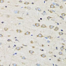 Anti-CLIC4 antibody used in IHC (Paraffin sections) (IHC-P). GTX33100