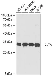 Anti-CLTA antibody used in Western Blot (WB). GTX33101