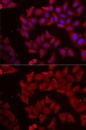 Anti-CMPK1 antibody used in Immunocytochemistry/ Immunofluorescence (ICC/IF). GTX33102