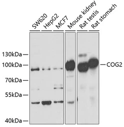 Anti-COG2 antibody used in Western Blot (WB). GTX33105