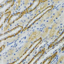 Anti-COG2 antibody used in IHC (Paraffin sections) (IHC-P). GTX33105