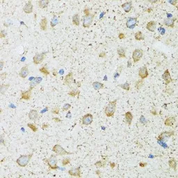 Anti-COG2 antibody used in IHC (Paraffin sections) (IHC-P). GTX33105