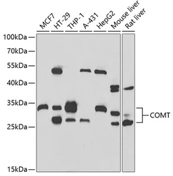 Anti-COMT antibody used in Western Blot (WB). GTX33108