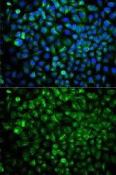 Anti-COMT antibody used in Immunocytochemistry/ Immunofluorescence (ICC/IF). GTX33108