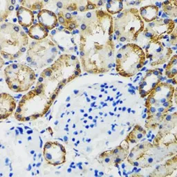 Anti-COMT antibody used in IHC (Paraffin sections) (IHC-P). GTX33108