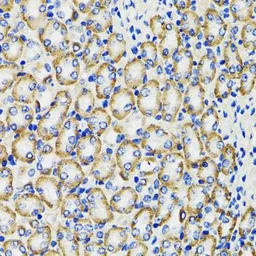 Anti-COMT antibody used in IHC (Paraffin sections) (IHC-P). GTX33108