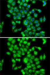Anti-COPS3 antibody used in Immunocytochemistry/ Immunofluorescence (ICC/IF). GTX33109