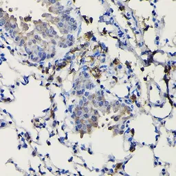 Anti-COTL1 antibody used in IHC (Paraffin sections) (IHC-P). GTX33112