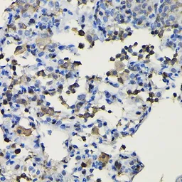 Anti-COTL1 antibody used in IHC (Paraffin sections) (IHC-P). GTX33112