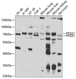 Anti-COX1 antibody used in Western Blot (WB). GTX33113