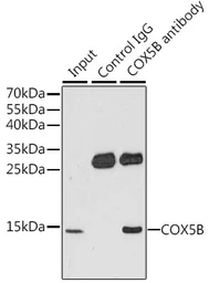 Anti-COX5B antibody used in Immunoprecipitation (IP). GTX33114