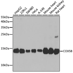 Anti-COX5B antibody used in Western Blot (WB). GTX33114