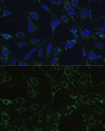 Anti-COX5B antibody used in Immunocytochemistry/ Immunofluorescence (ICC/IF). GTX33114