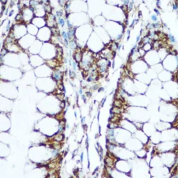 Anti-COX5B antibody used in IHC (Paraffin sections) (IHC-P). GTX33114
