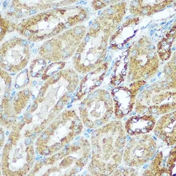 Anti-COX5B antibody used in IHC (Paraffin sections) (IHC-P). GTX33114